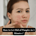 Woman touching face with acne – How to get rid of pimples in 5 minutes with fast home remedies